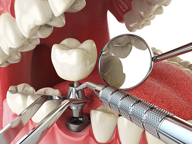 Best Broken or Cracked Tooth Emergency Dentist in Combee Settlement, FL